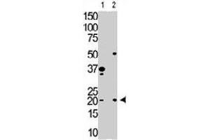 The HPCA polyclonal antibody  is used in Western blot to detect HPCA in Y79 cell lysate (Lane 1) and mouse brain tissue lysate (Lane 2) . (Hippocalcin Antikörper  (N-Term))