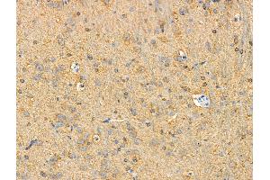 ABIN7093276 and ABIN7097295 at 1/100 staining Rat brain tissue by IHC-P.