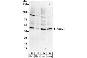 anti-Activating Signal Cointegrator 1 Complex Subunit 1 (ASCC1) (AA 1-50) antibody
