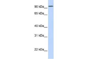 DPP6 antibody used at 1 ug/ml to detect target protein.
