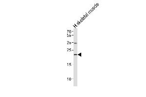 Western blot analysis of lysate from human skeletal muscle tissue lysate,using IFNW1 Antibody was diluted at 1:1000. (IFNW1 Antikörper)