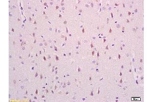 Formalin-fixed and paraffin embedded rat brain labeled with Anti phospho-NDEL1(Ser231) Polyclonal Antibody,Unconjugated (ABIN710801) at 1:200 followed by conjugation to the secondary antibody and DAB staining. (NDEL1 Antikörper  (pSer231))