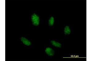 Immunofluorescence of purified MaxPab antibody to TINF2 on HeLa cell.