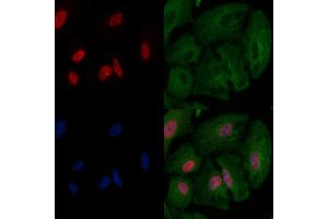 ABIN6263158 and ABIN6266586 staining  cells by IF/ICC. (MCM2 Antikörper  (N-Term))