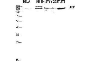 Western Blot (WB) analysis of HeLa KB SH-SY5Y 293T 3T3 lysis using Abl1 antibody. (ABL1 Antikörper  (Ser120, Ser121))