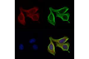 ABIN6264452 and ABIN6276642 staining Hela cells by IF/ICC. (PRSS1 Antikörper  (Internal Region))
