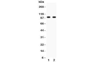 Western blot testing of Glutamate receptor 3 antibody and Lane 1:  rat brain;  2: mouse brain lysate. (Glutamate Receptor 3 Antikörper  (AA 29-360))