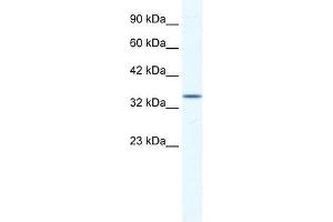 ZFP589 antibody (20R-1179) used at 0. (ZFP589 (Middle Region) Antikörper)
