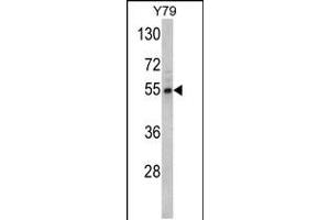 Western blot analysis of Fascin Antibody in Y79 cell line lysates (35ug/lane) (Fascin Antikörper  (AA 322-350))