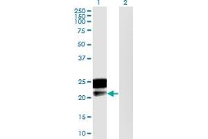 Western Blot analysis of DMRTB1 expression in transfected 293T cell line by DMRTB1 monoclonal antibody (M02), clone 5E7. (DMRTB1 Antikörper  (AA 1-189))
