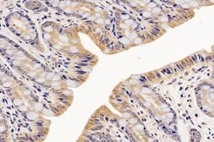 Immunohistochemistry analysis of paraffin-embedded rat rectum using,NME7 (ABIN7074918) at dilution of 1: 4200