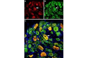 Multiplex staining of ASIC1 and ASIC3 in rat DRGImmunohistochemical staining of perfusion-fixed frozen rat dorsal root ganglia (DRG) sections using Guinea pig Anti-ASIC1 Antibody (ABIN7042914, ABIN7045410 and ABIN7045411), (1:400) and rabbit Anti-ASIC3 Antibody (ABIN7042917, ABIN7045243 and ABIN7045244), (1:400).