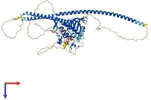 TLK1 Protein (AA 1-766) (His tag)