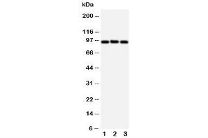 Western blot testing of ABCB6 antibody and Lane 1:  HeLa (ABCB6 Antikörper  (C-Term))