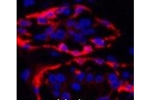 Immunofluorescence analysis of Human breast tissue using CK-17 Monoclonal Antibody at dilution of 1:200. (KRT17 Antikörper)