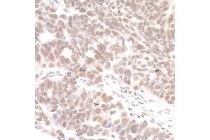 Immunohistochemistry (IHC) image for anti-DEAH (Asp-Glu-Ala-His) Box Polypeptide 8 (DHX8) (AA 325-375) antibody (ABIN7454652)
