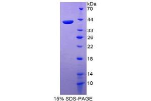 SDS-PAGE (SDS) image for Chemokine (C-C Motif) Ligand 22 (CCL22) (AA 25-93) protein (His tag,GST tag) (ABIN1877719)