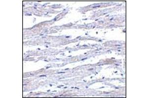 Immunohistochemistry of RIG-1 in human heart tissue with this product at 5 μg/ml. (DDX58 Antikörper)