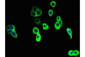 Immunofluorescent analysis of A431 cells using ABIN7161614 at dilution of 1:100 and Alexa Fluor 488-congugated AffiniPure Goat Anti-Rabbit IgG(H+L) (NINJ2 Antikörper  (AA 17-81))
