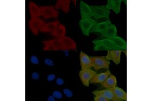 ABIN6258546 and ABIN6275024 staining Hela cells(24h of starvation treatment) by IF/ICC. (CCDC102A Antikörper  (Internal Region))
