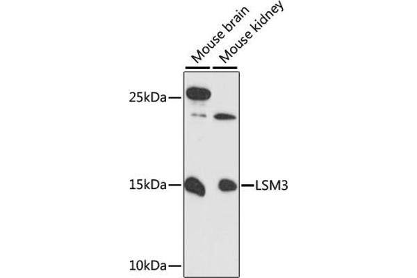 LSM3 anticorps  (AA 1-102)