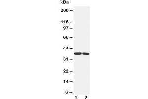 Western blot testing of IGFBP1 antibody and Lane 1:  SMMC-7721;  2: MCF-7 cell lysate (IGFBPI Antikörper  (Middle Region))