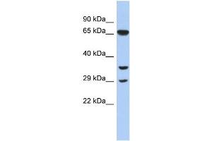 WB Suggested Anti-RYBP Antibody Titration:  0. (RYBP Antikörper  (N-Term))