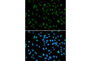 Immunofluorescence analysis of A549 cells using WHSC1L1 antibody (ABIN5973250).