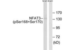 Western Blotting (WB) image for anti-Nuclear Factor of Activated T-Cells, Cytoplasmic, Calcineurin-Dependent 4 (NFATC4) (AA 136-185), (pSer168) antibody (ABIN482772) (NFATC4 Antikörper  (pSer168))
