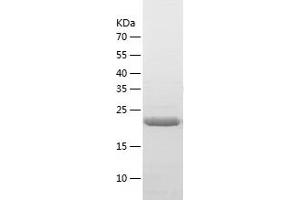 Western Blotting (WB) image for BCL2-Like 1 (BCL2L1) (AA 1-209) protein (His tag) (ABIN7121986) (BCL2L1 Protein (AA 1-209) (His tag))