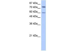 IGF2BP1 antibody used at 0.