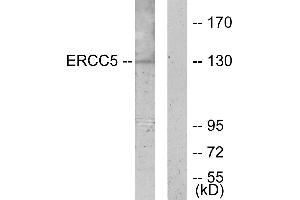 Western blot analysis of extracts from K562 cells, using ERCC5 antibody. (ERCC5 Antikörper  (Internal Region))