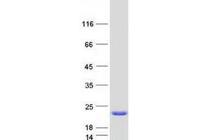 Validation with Western Blot (ARF1 Protein (Transcript Variant 4) (Myc-DYKDDDDK Tag))