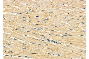 ABIN6262032 and ABIN6278985 at 1/100 staining Rat heart tissue by IHC-P. (GOLT1B Antikörper  (C-Term))