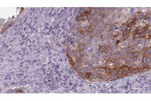 Immunohistochemistry (IHC) image for anti-Guanine Nucleotide Binding Protein, alpha Stimulating, Olfactory Type (GNAL) (Internal Region) antibody (ABIN6259085)