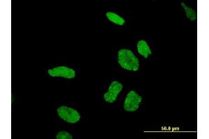 Immunofluorescence (IF) image for anti-DEAD/H (Asp-Glu-Ala-Asp/His) Box Polypeptide 11 (DDX11) (AA 1-970) antibody (ABIN514945)