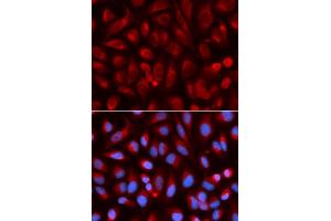 Immunofluorescence analysis of U2OS cells using ADA antibody. (ADA Antikörper)