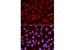 Immunofluorescence analysis of U2OS cells using ADA antibody.