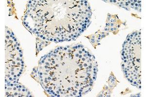 ABIN6266305 and ABIN6277424 at 1/100 staining Mouse testis tissue by IHC-P. (PDK4 Antikörper  (C-Term))
