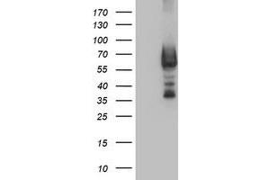 Western Blotting (WB) image for anti-Dystrobrevin, beta (DTNB) antibody (ABIN1497916) (Dystrobrevin beta Antikörper)