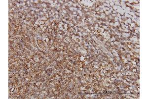 Immunoperoxidase of monoclonal antibody to PTGIR on formalin-fixed paraffin-embedded human tonsil. (Prostacyclin Receptor Antikörper  (AA 296-386))