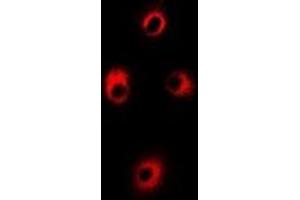 Immunofluorescent analysis of ALAS-H staining in Hela cells. (ALAS1 Antikörper)