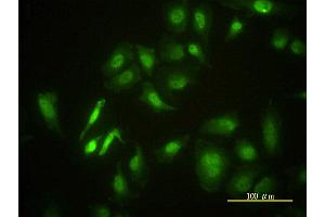Immunofluorescence of monoclonal antibody to STK4 on HeLa cell. (STK4 Antikörper  (AA 1-39))