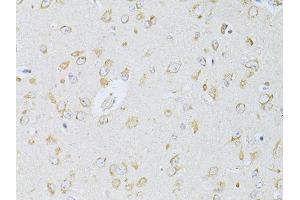 Immunohistochemistry of paraffin-embedded rat brain using NTS antibody (ABIN6290694) at dilution of 1:100 (40x lens). (Neurotensin Antikörper)