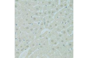 Immunohistochemistry of paraffin-embedded rat liver using PHOX2B antibody (ABIN5995873) at dilution of 1/100 (40x lens).