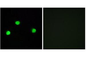 Immunofluorescence (IF) image for anti-Inositol Hexakisphosphate Kinase 2 (IP6K2) (Internal Region) antibody (ABIN1850058)