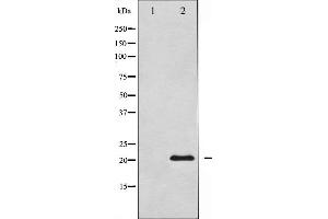 Western blot analysis of Survivin expression in Mouse lungtissue lysates,The lane on the left is treated with the antigen-specific peptide. (Survivin Antikörper  (Internal Region))