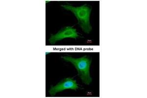 ICC/IF Image Immunofluorescence analysis of paraformaldehyde-fixed HeLa, using PHLP, antibody at 1:200 dilution. (Phosducin-Like Antikörper)