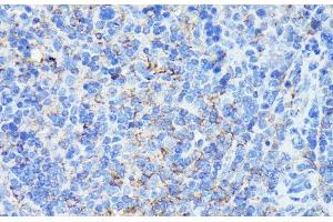 Immunohistochemistry of paraffin-embedded Mouse spleen using MADCAM1 Polyclonal Antibody at dilution of 1:100 (40x lens). (MADCAM1 Antikörper)