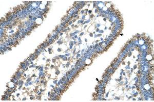 Human Intestine (CPS1 Antikörper  (N-Term))